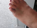 my swollen toe!  it hurts!